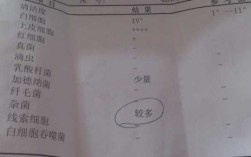 关于取白带过程的信息