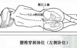 腰椎穿刺的过程（腰椎穿刺过程要多久）