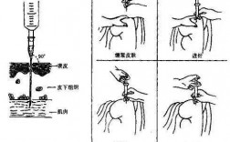 打屁股针过程（打屁股针过程中出血了怎么办）