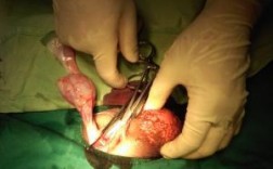 做睾丸切除手术过程图（做睾丸切除有什么要求）