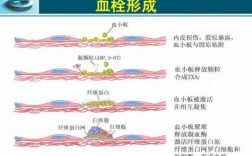 血栓的形成过程病理（血栓的形成过程病理变化）