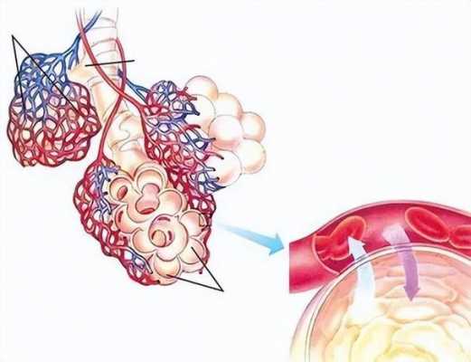 肺气肿形成过程（肺气肿形成过程是什么）-图2