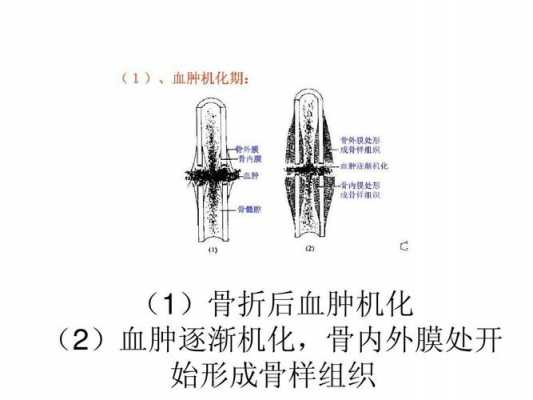 骨折愈合过程细胞形态（骨折骨细胞生长过程）-图1