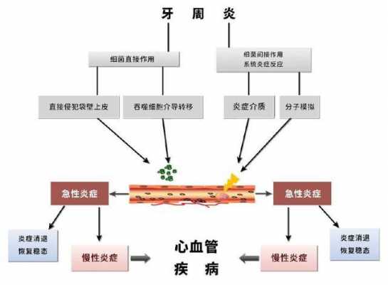 牙周病演变过程（牙周病的发病机制）-图2