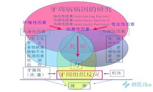 牙周病演变过程（牙周病的发病机制）-图1