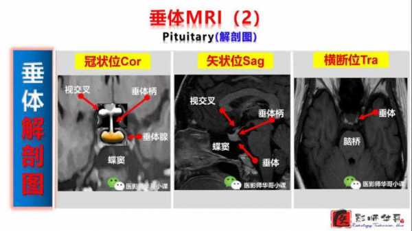 核磁共振检查过程（儿童垂体核磁共振检查过程）-图1