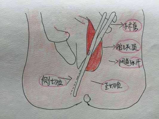 分娩外阴消毒过程视频（分娩消毒顺序视频教程）-图2