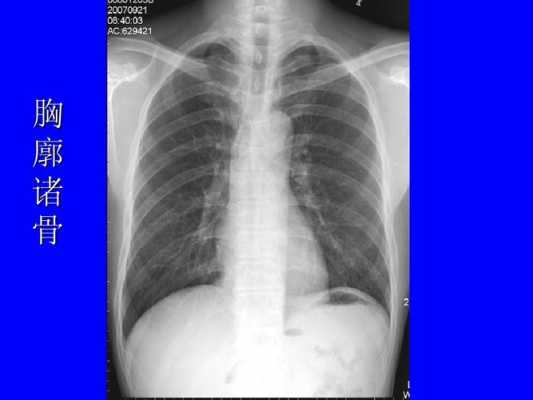 呼吸过程x光（x线摄影中呼吸方式的应用）-图1