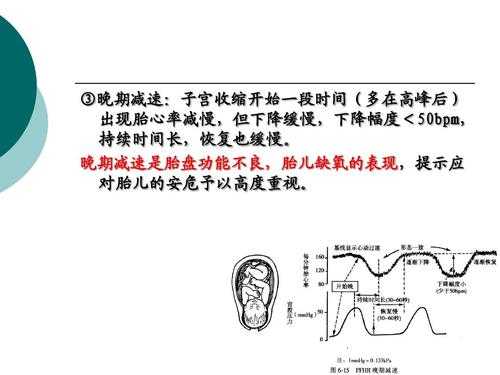 生宝宝过程（生宝宝过程中胎心率下降）-图2