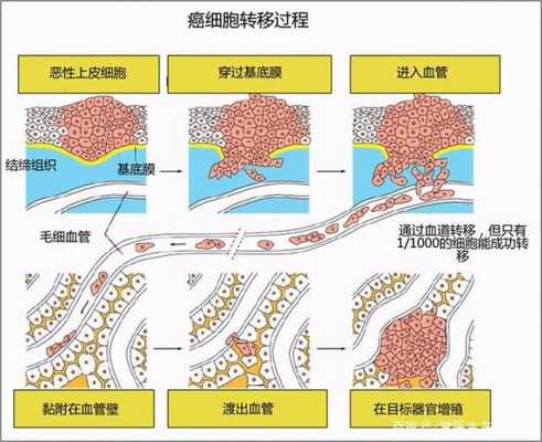 癌细胞扩散活检过程（活检 癌细胞扩散）-图1