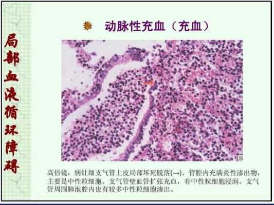 充血的形成过程（充血发生在什么血管）-图2