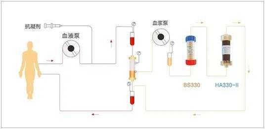 dpmas治疗过程（dms的治疗原理）-图2