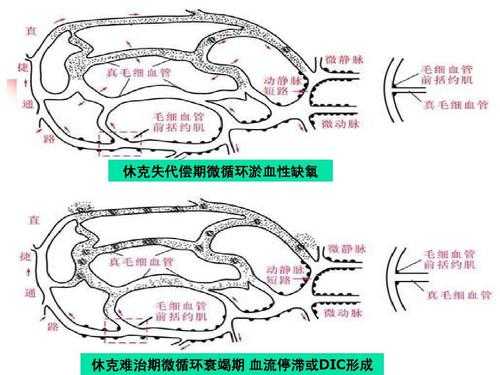 休克过程必经dic阶段（休克发生的环节）-图2