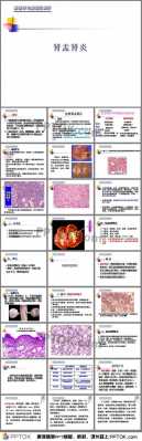 简述病理过程（病理过程怎么描述）-图2