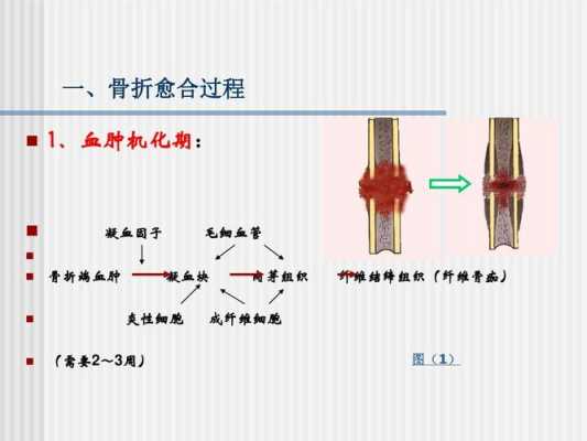 骨折愈合过程中必须经过的过程（骨折愈合过程中必须经过的过程包括）-图3