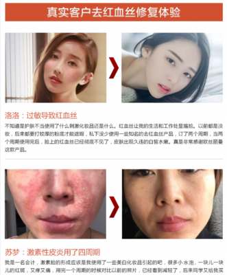 激素脸排毒过程（激素脸排毒过程症状）-图2