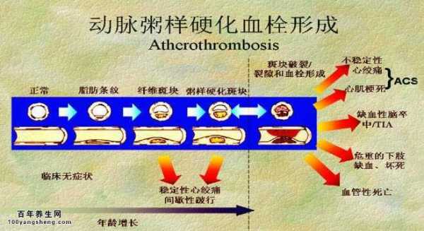 血栓行程的过程顺序（血栓形成过程包括两个基本过程分别是）-图3