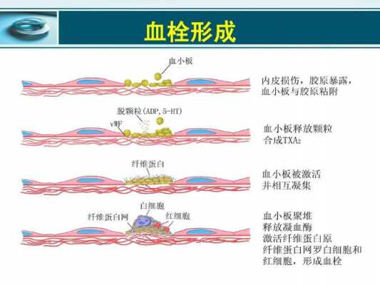 血栓行程的过程顺序（血栓形成过程包括两个基本过程分别是）-图1