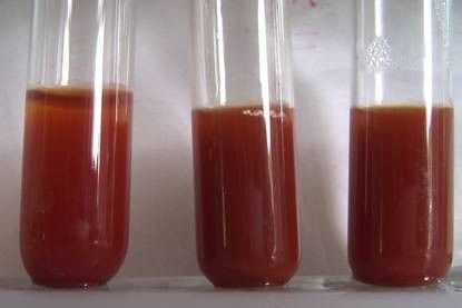 乙醛砖红色沉淀过程（乙醛的砖红色沉淀反应）-图1