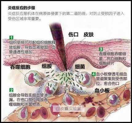 炎症修复过程（炎症修复是什么意思）-图1