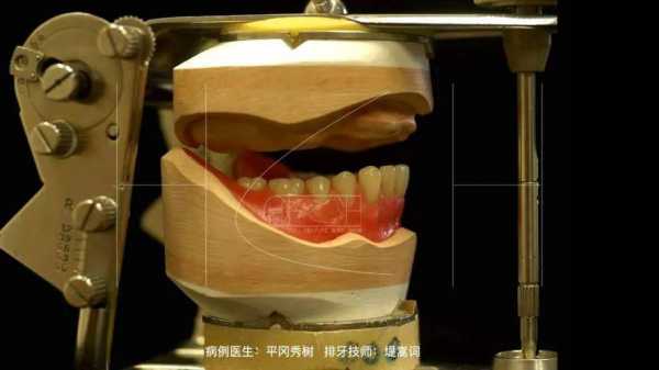 排牙的全过程（排牙的全过程视频）-图2