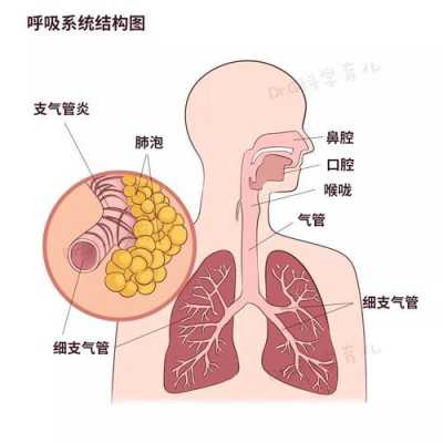 支气管炎的过程（急性支气管炎的过程）-图2