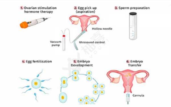 人工授精移植的过程（人工授精和胚胎移植技术）-图1