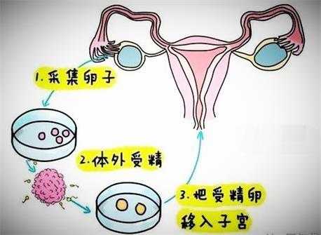 人工授精移植的过程（人工授精和胚胎移植技术）-图3