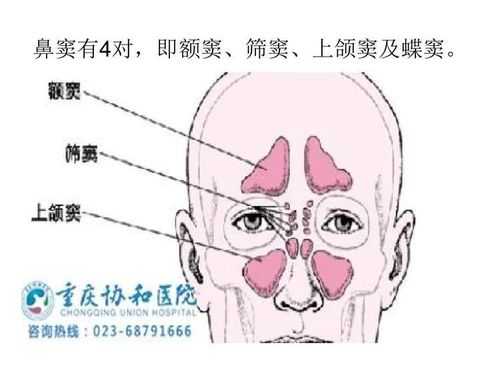 蝶窦发育过程（蝶窦扩大的原因）-图3