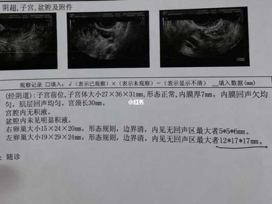 监测卵泡过程（监测卵泡过程需要多长时间）-图2