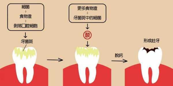 牙齿病变的过程（牙齿有病变是怎么回事）-图2