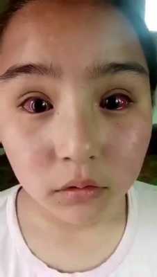 换眼睛过程（换眼睛视频）-图3