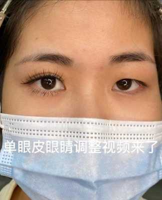 换眼睛过程（换眼睛视频）-图1