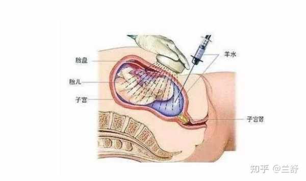 引产过程打针的作用（引产打针是什么作用）-图3