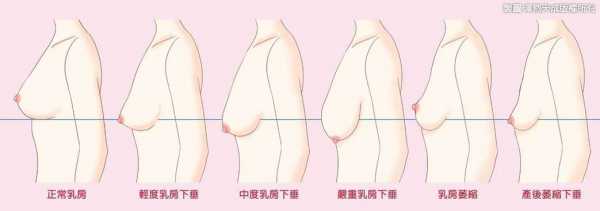 产妇乳房变化过程（生产后乳房的变化）-图2