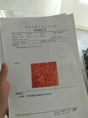 子宫内膜活检过程图片（子宫内膜活检要几天出结果）-图2