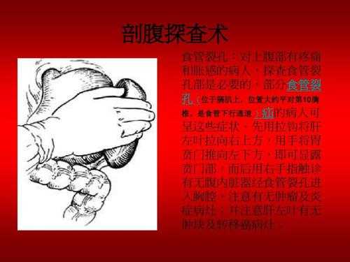 剖腹探查术过程（剖腹探查术视频教程）-图2