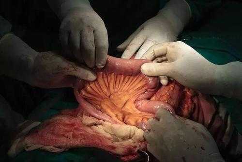 挖美女肠子过程（剖美女肚子挖肠子）-图2
