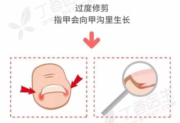 指甲的生长过程（指甲的生长过程视频教程）-图2