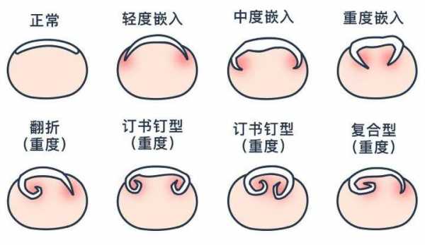 指甲的生长过程（指甲的生长过程视频教程）-图3