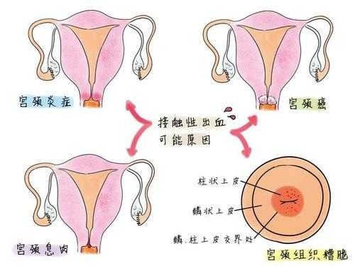 性的过程bbc（性的过程女性出血是怎么回事）-图3