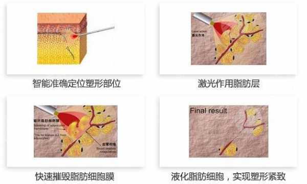 肌功能整塑过程（肌功能整塑怎么做）-图3