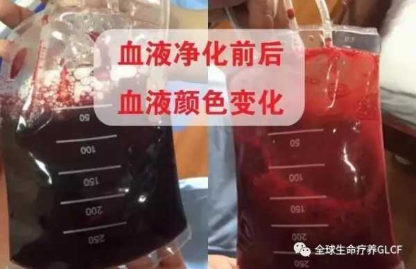 血液腐坏的过程（血液损坏的原因是什么）-图2