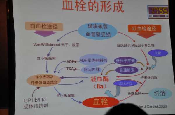 血栓形成过程简介（血栓形成过程简介图）-图1