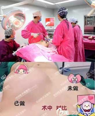 美女隆胸过程视频（美女隆胸过程视频在线观看）-图3