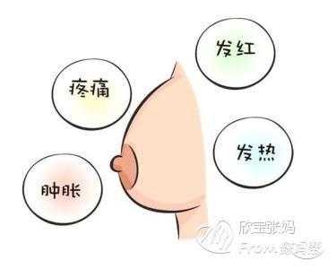 回奶过程中乳房有硬块（回奶过程中乳房有硬块,疼痛）-图1