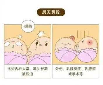 乳头的生长过程（乳头生长会痛吗）-图2