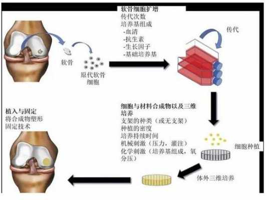 骨损伤修复过程（骨损伤修复过程图片）-图3