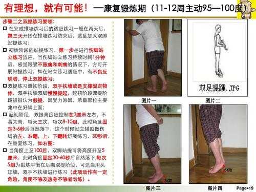 跟腱术后锻炼过程（跟腱术后恢复期）-图2