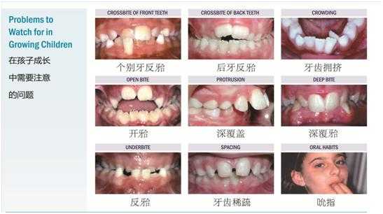 牙齿发育过程（牙齿发育不良）-图2